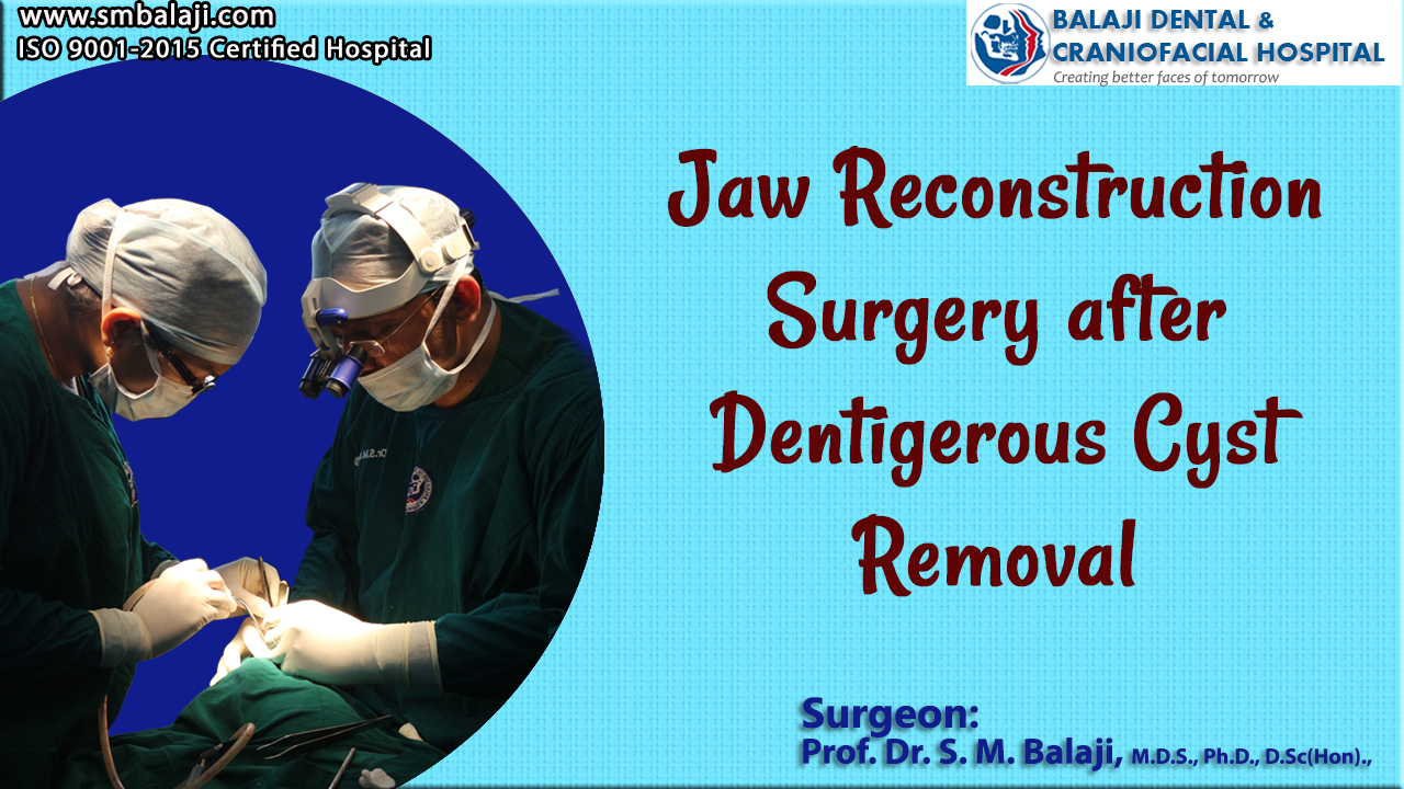 Jaw Reconstruction Surgery after Dentigerous Cyst Removal