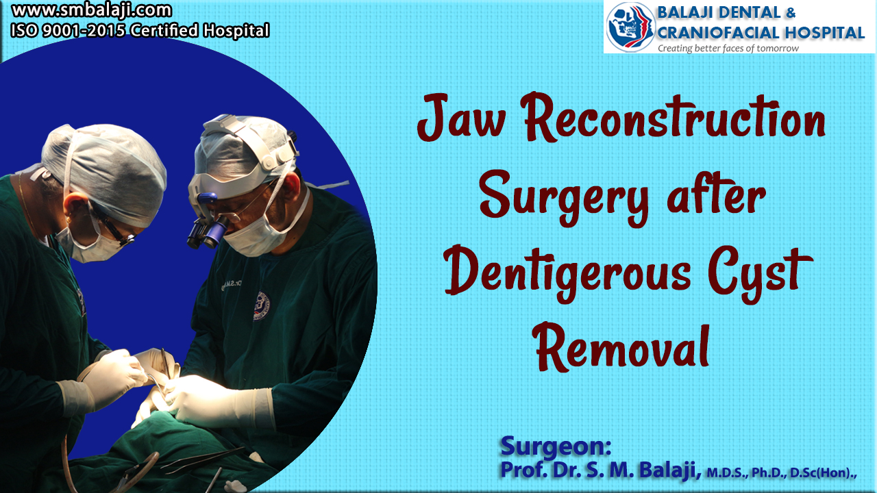 Jaw Reconstruction Surgery After Dentigerous Cyst Removal