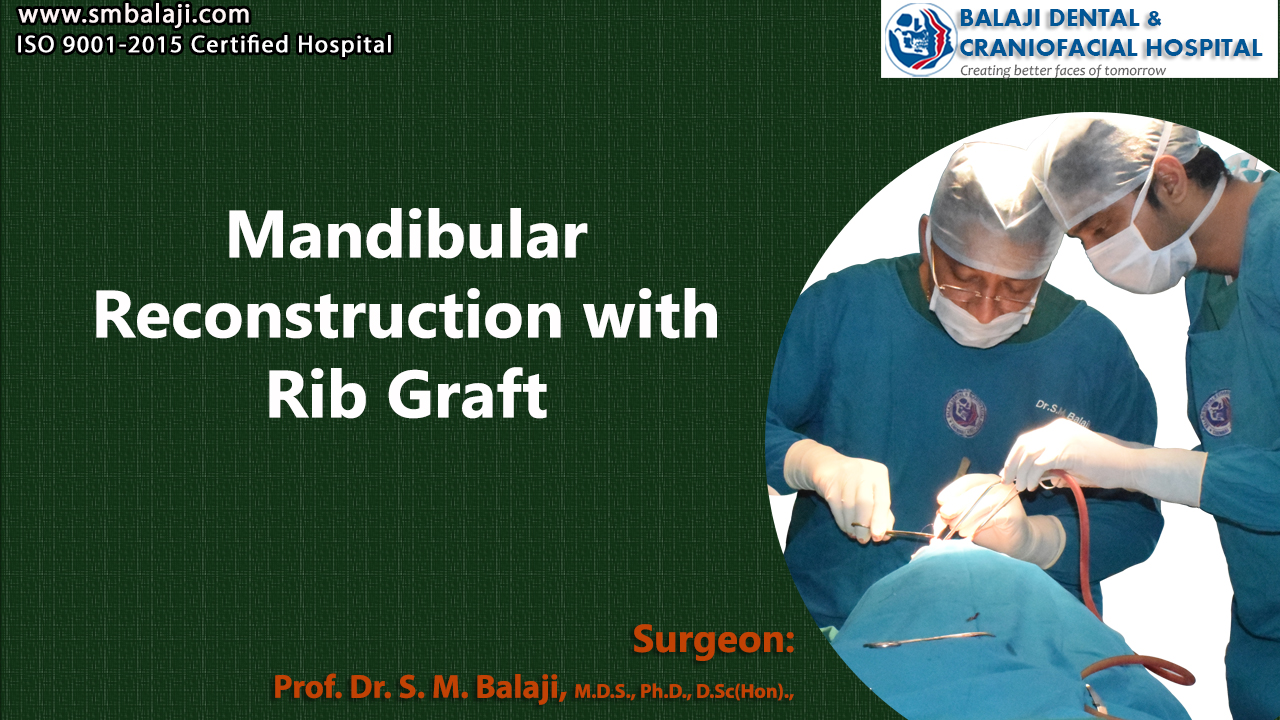 Mandibular Reconstruction With Rib Graft