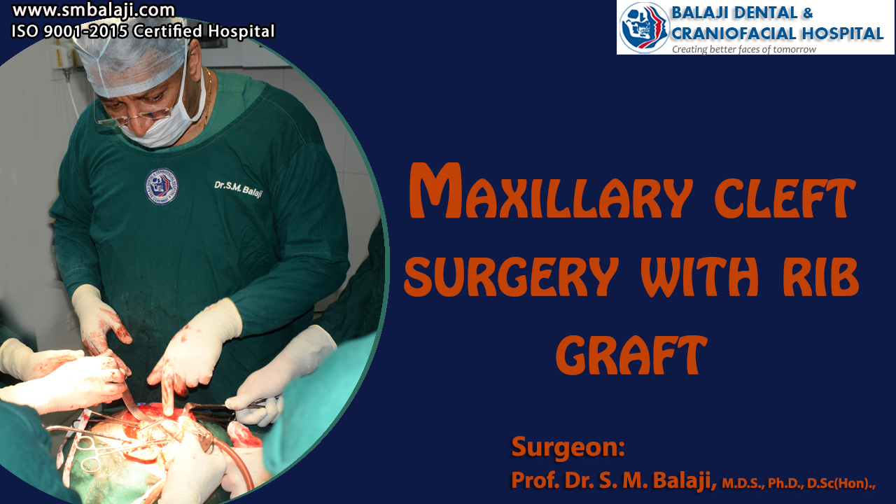 Maxillary Cleft Surgery With Rib Graft