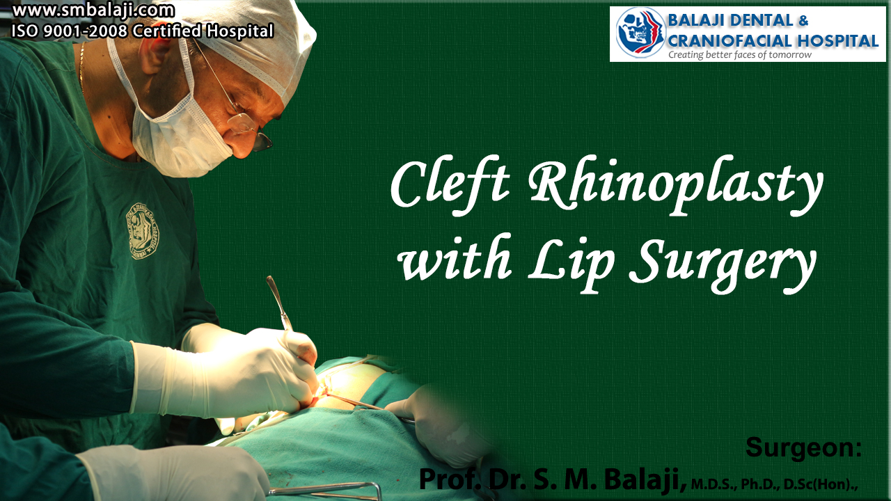 Cleft Rhinoplasty With Lip Surgery