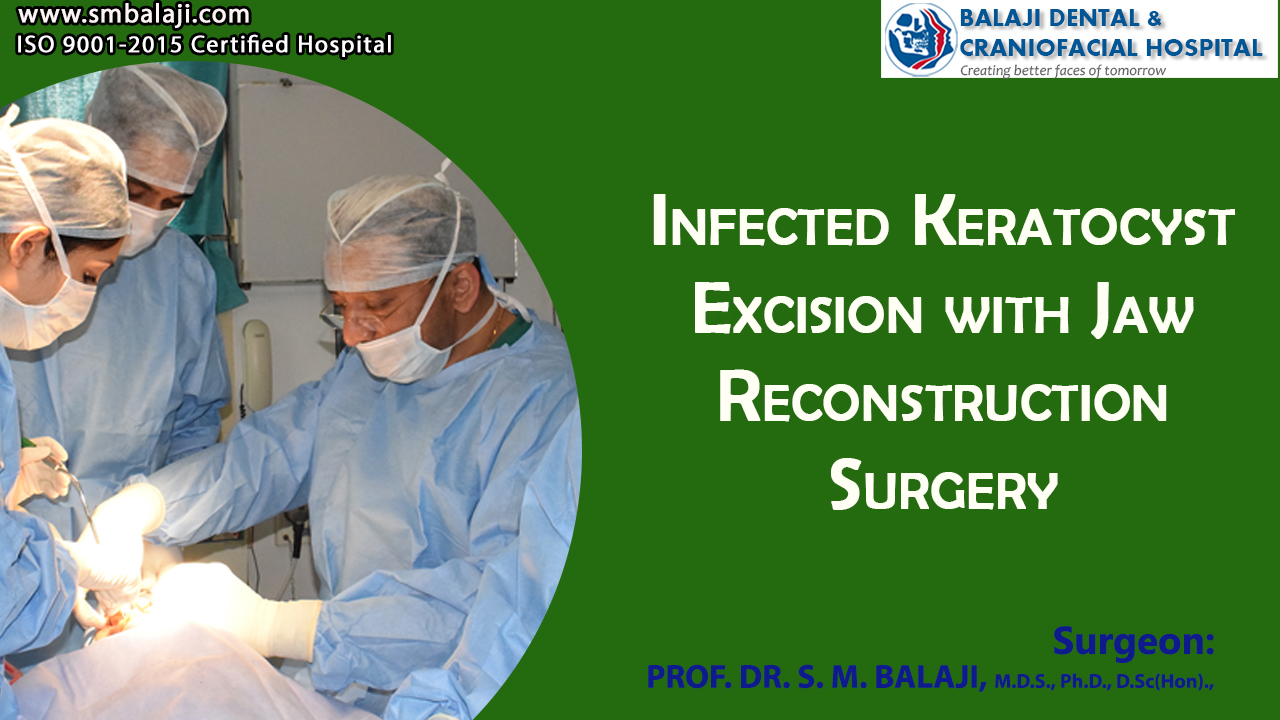 Infected keratocyst excision with Jaw Reconstruction Surgery