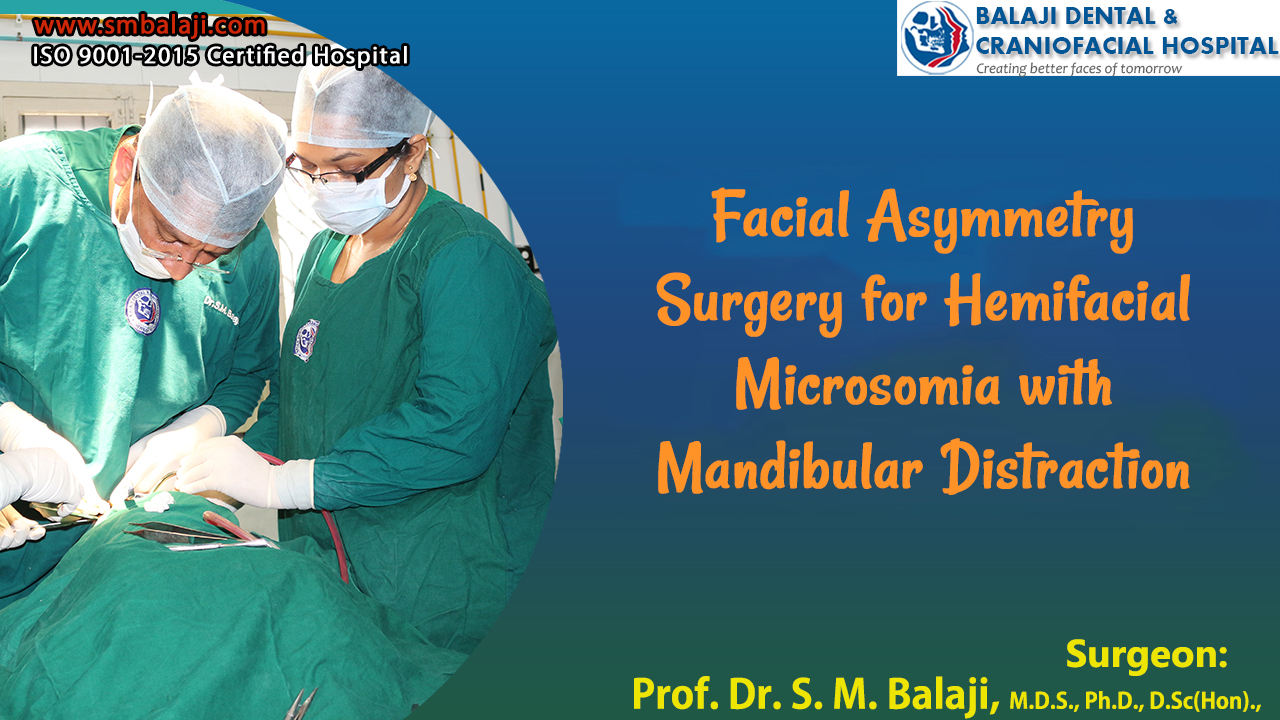 Facial Asymmetry Surgery for Hemifacial Microsomia with Mandibular Distraction