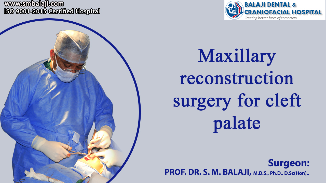 Maxillary reconstruction surgery for cleft palate