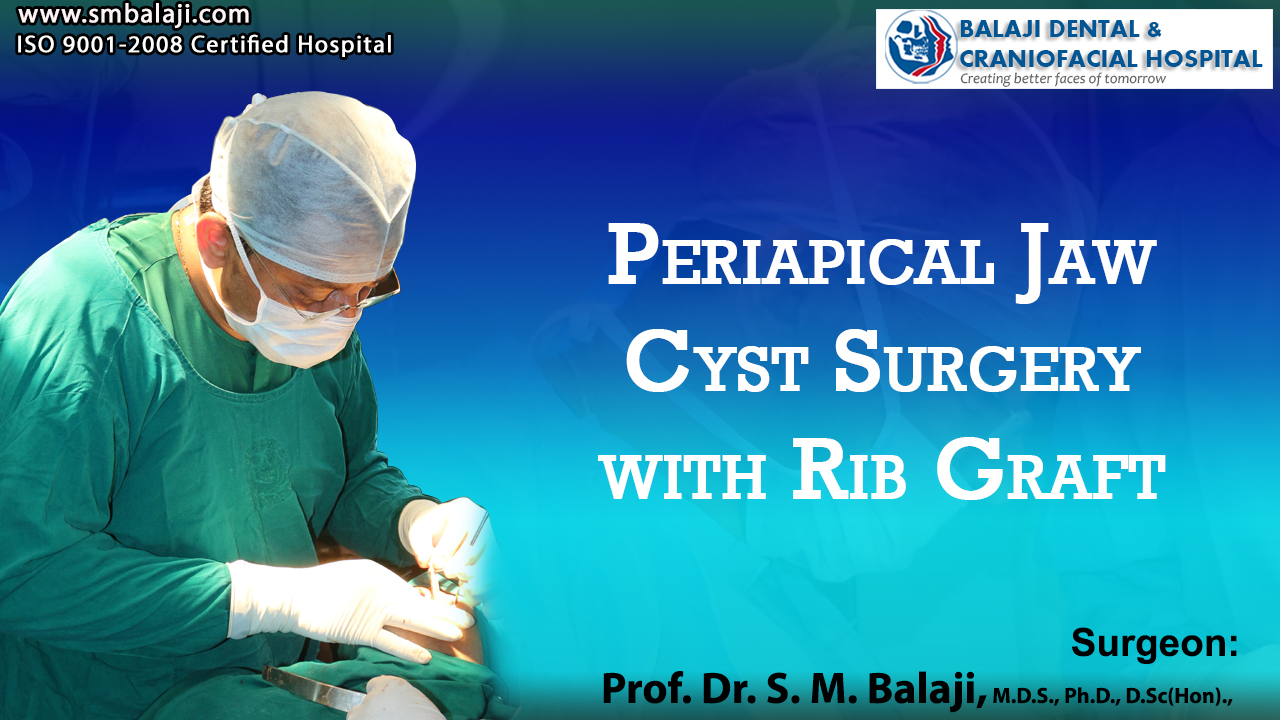 Periapical Jaw Cyst Surgery with Rib Graft