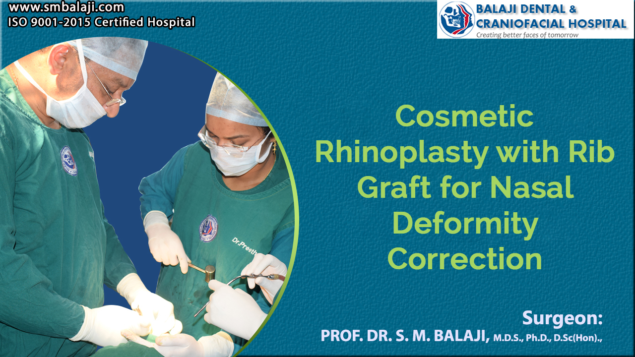 Cosmetic Rhinoplasty with Rib Graft for Nasal Deformity Correction