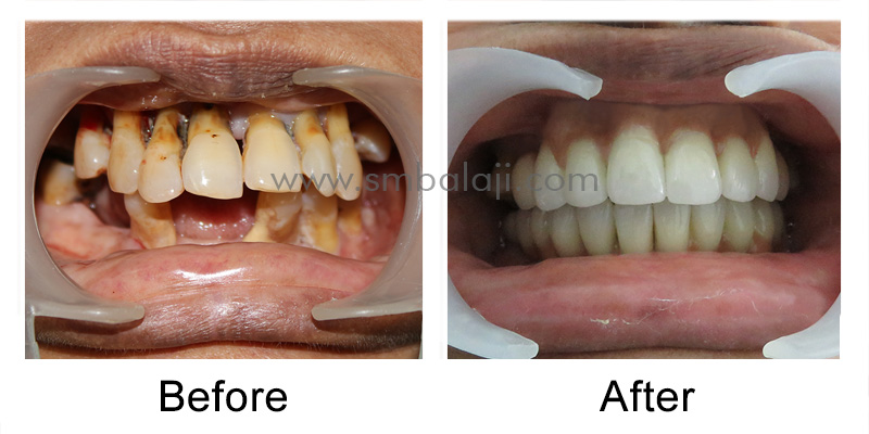 Patients oral condition before and after