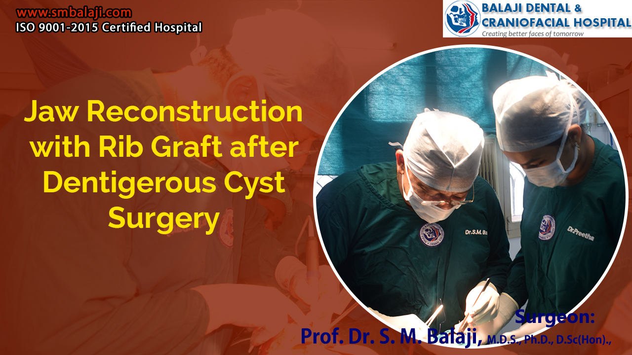 Jaw Reconstruction with Rib Graft after Dentigerous Cyst Surgery