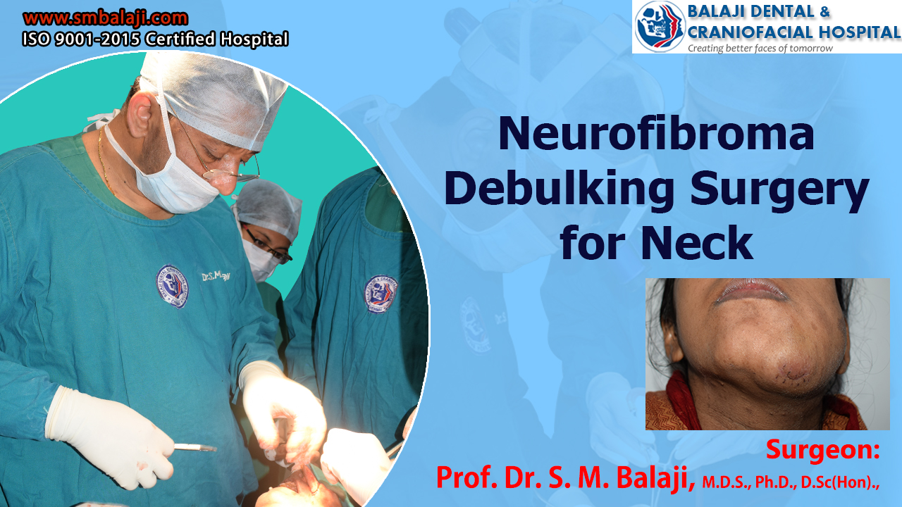 Neurofibroma Debulking Surgery for Neck