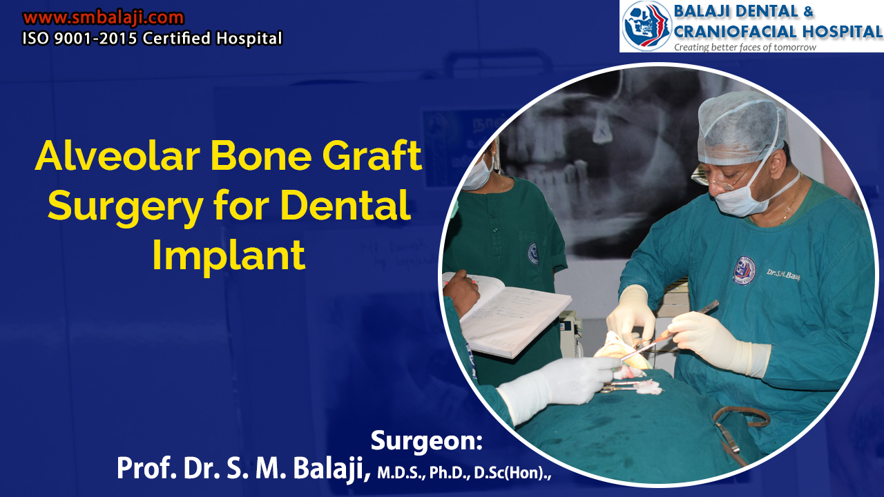 Alveolar Bone Graft Surgery for Dental Implant