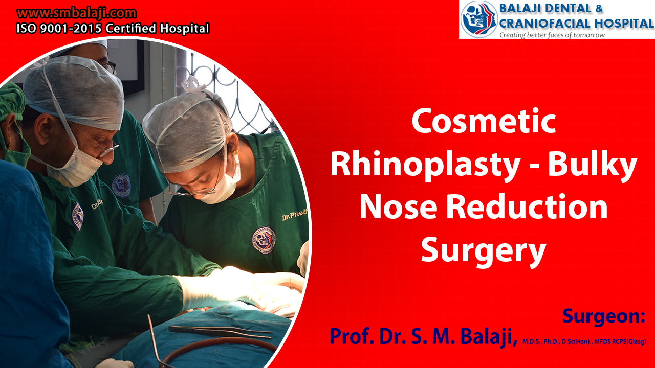 Cosmetic Rhinoplasty – Bulky Nose Reduction Surgery