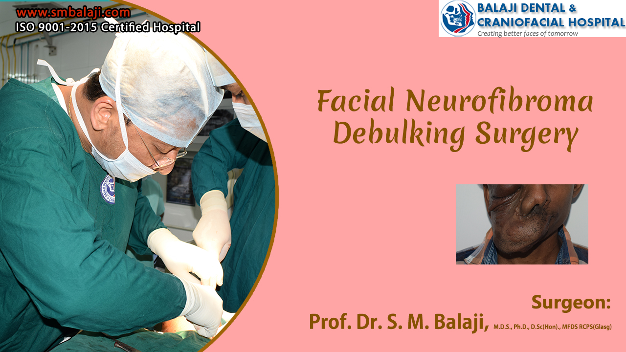 Facial Neurofibroma Debulking Surgery