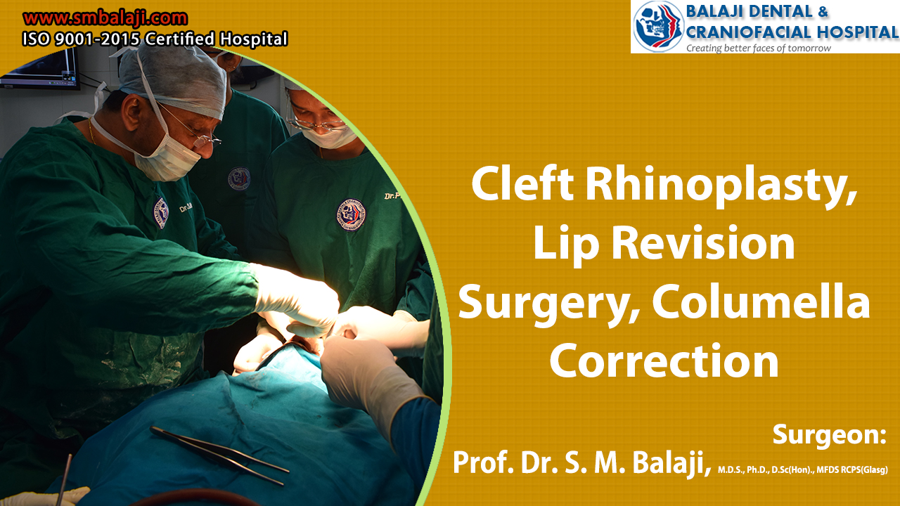 Cleft Rhinoplasty, Lip Revision Surgery, Columella Correction