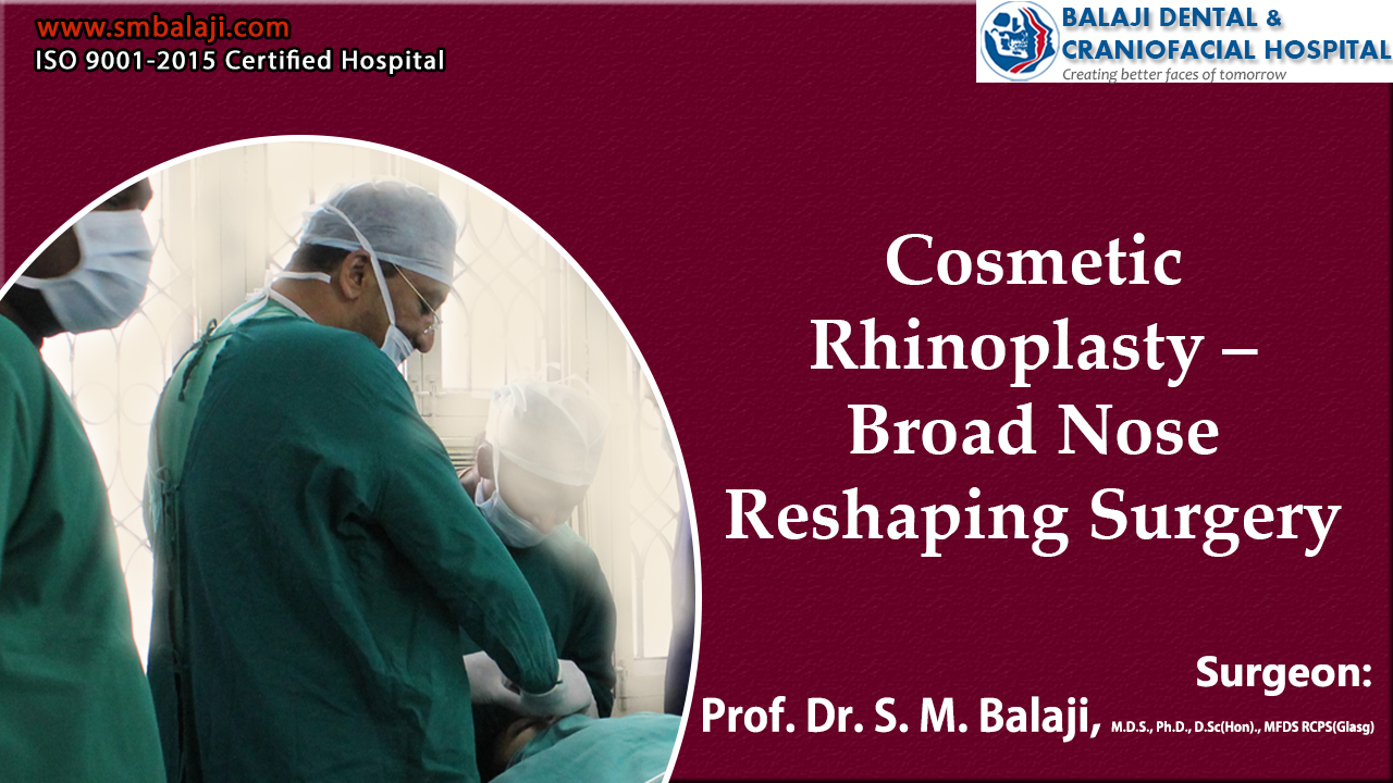 Cosmetic Rhinoplasty – Broad Nose Reshaping Surgery