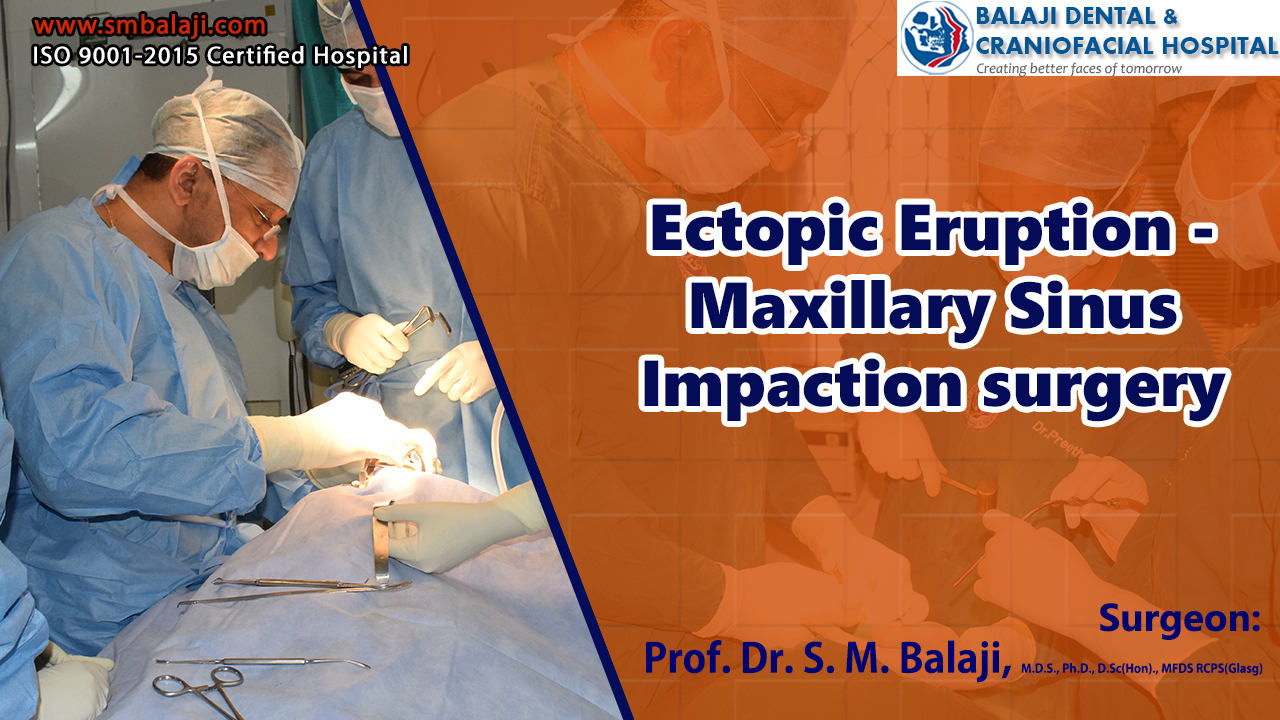 Ectopic Eruption - Maxillary Sinus Impaction surgery