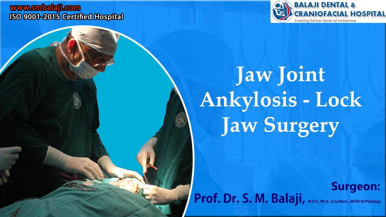 Jaw Joint Ankylosis - Lock Jaw Surgery