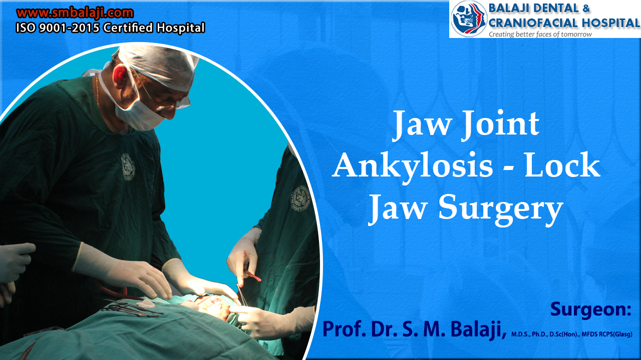 Jaw Joint Ankylosis – Lock Jaw Surgery