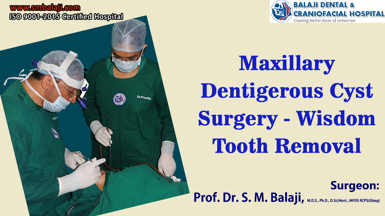 Maxillary Dentigerous Cyst Surgery – Wisdom Tooth Removal