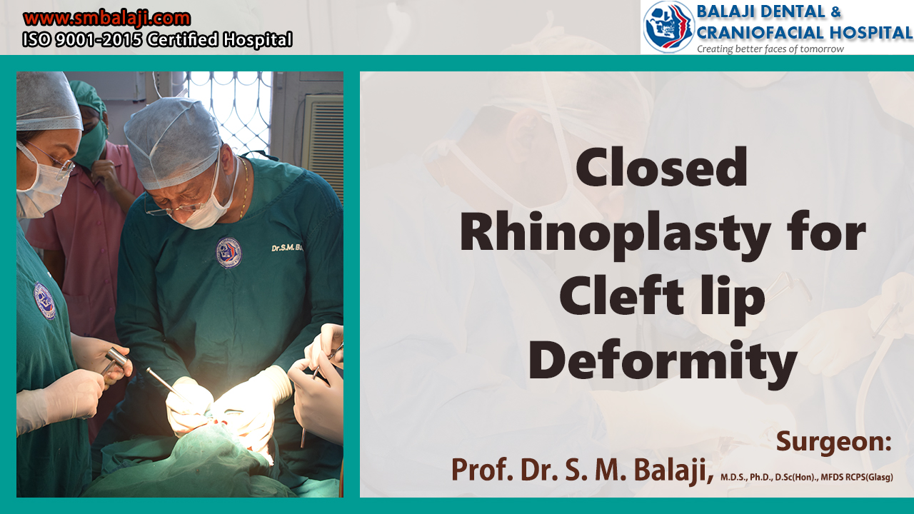 Closed Rhinoplasty - Nasal Deformity Correction Surgery