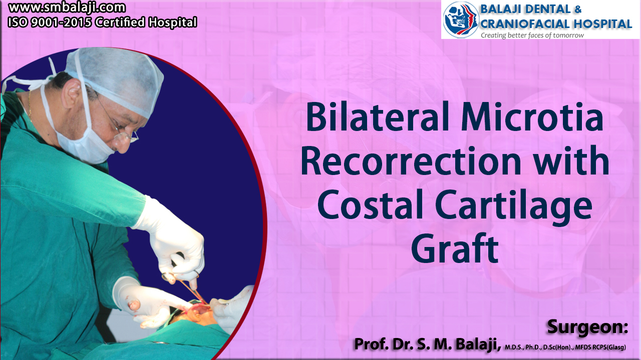 Bilateral Microtia Recorrection with Costal Cartilage Graft