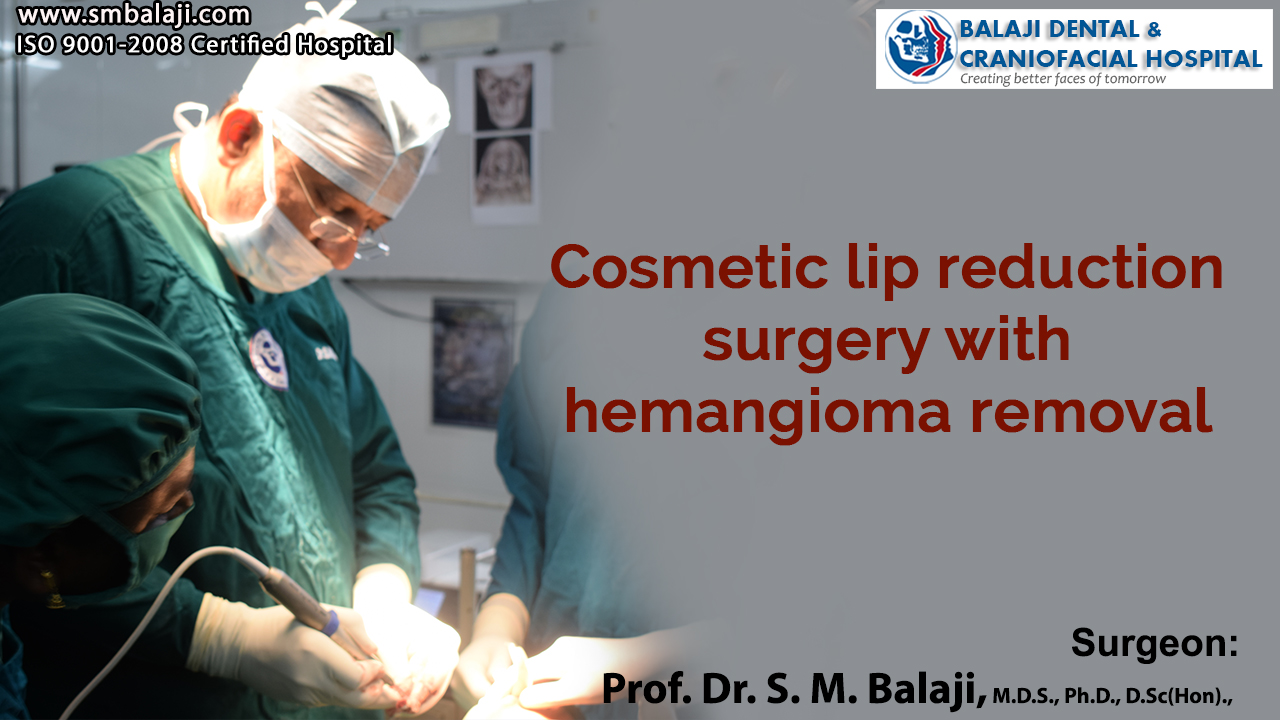 Cosmetic lip reduction surgery with hemangioma removal