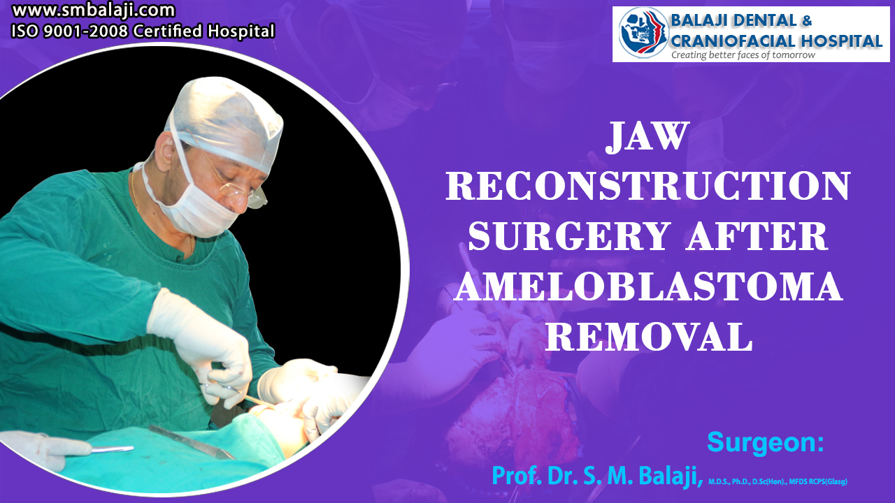 Jaw Reconstruction Surgery after Ameloblastoma Removal