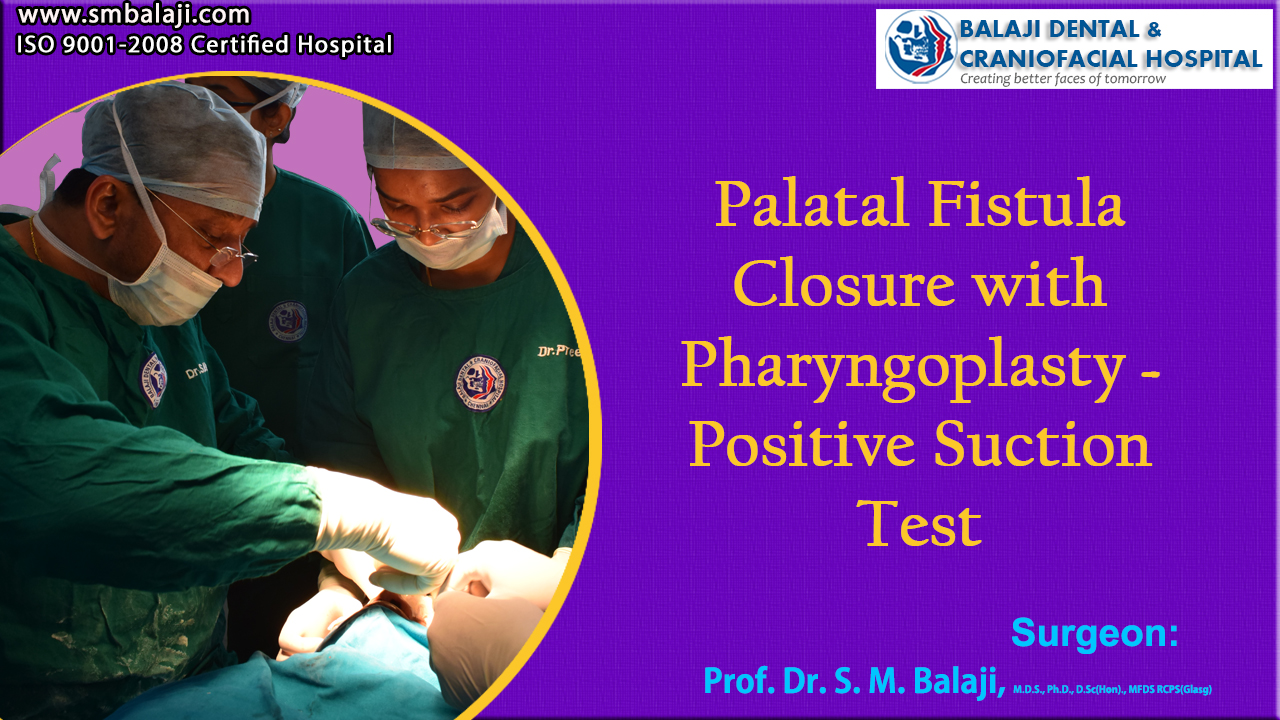 Palatal fistula closure Pharyngoplasty – Positive Suction Test