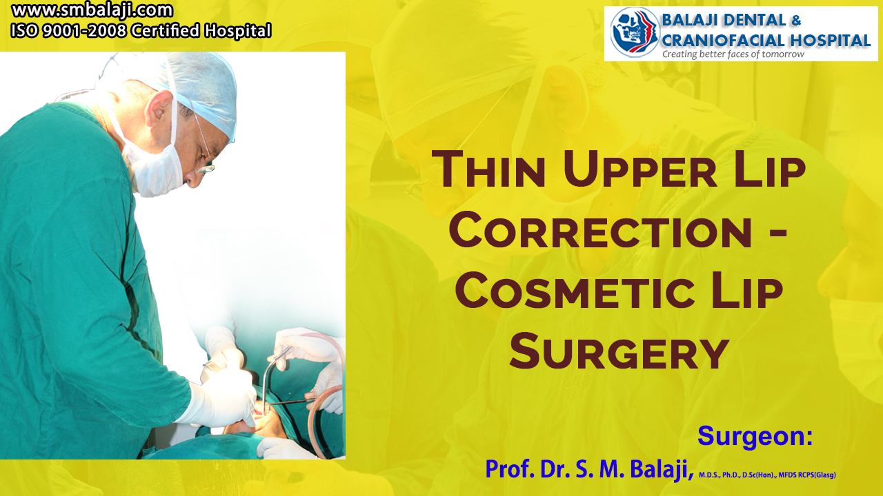 Thin upper lip correction – Cosmetic Lip Surgery