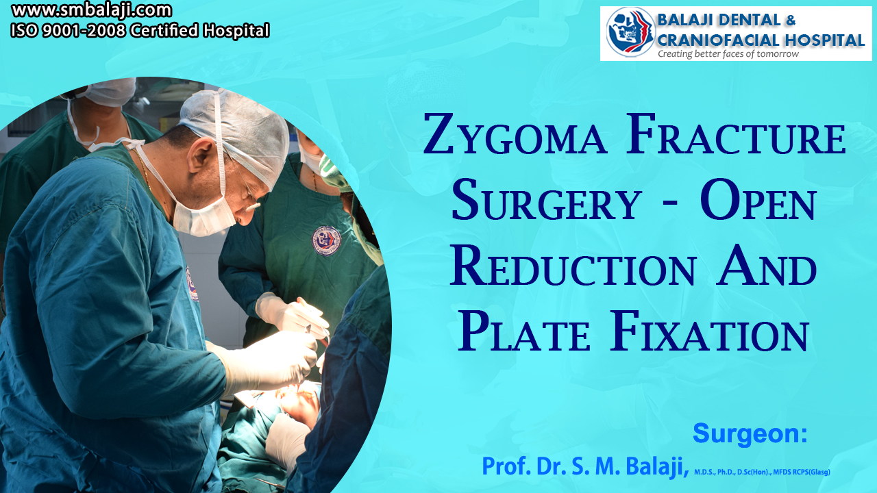 Zygoma Fracture Surgery - Open Reduction and Plate Fixation