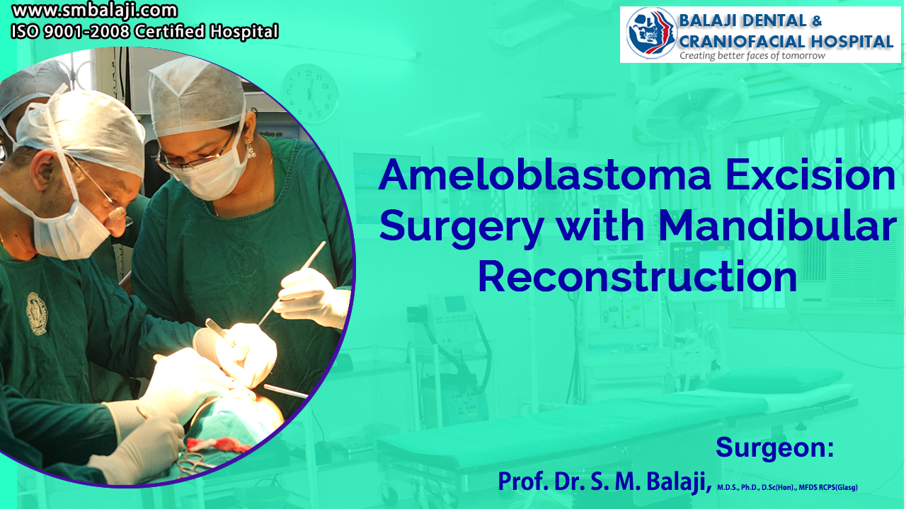 Ameloblastoma Excision Surgery with Mandibular Reconstruction