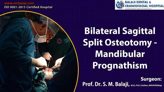 Bilateral Sagittal Split Osteotomy - Mandibular Prognathism