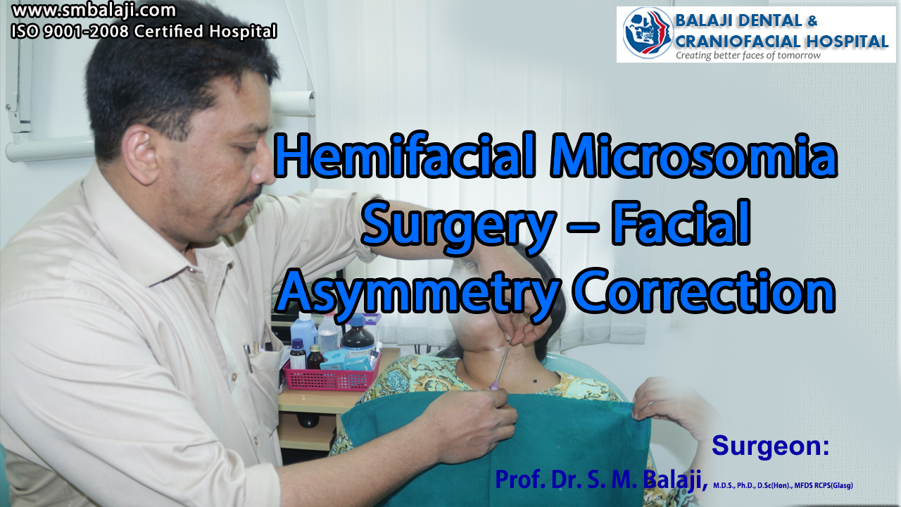 Hemifacial Microsomia Surgery – Facial Asymmetry Correction