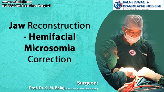 Jaw Reconstruction – Hemifacial Microsomia Correction