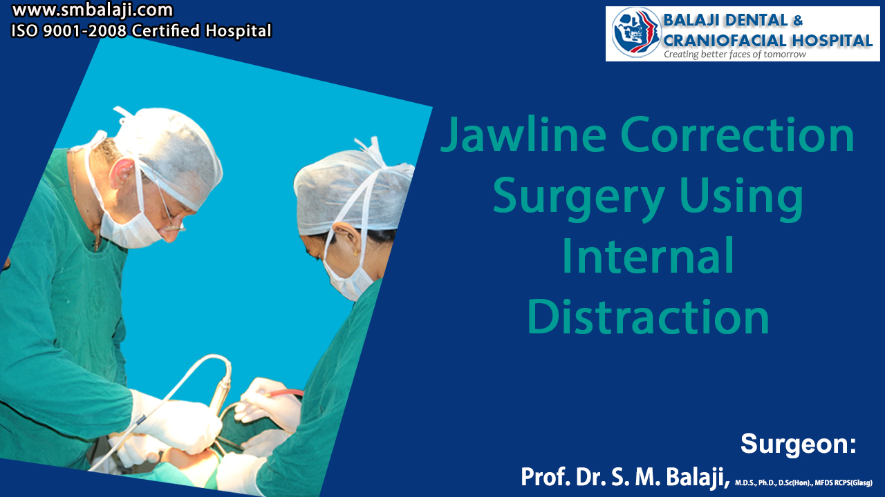 Jawline Correction Surgery Using Internal Distraction