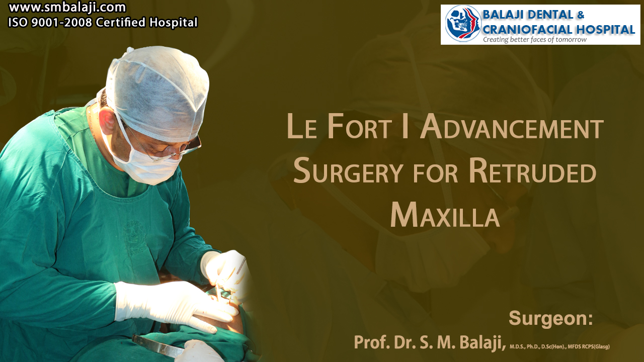 Le Fort I Advancement Surgery for Retruded Maxilla