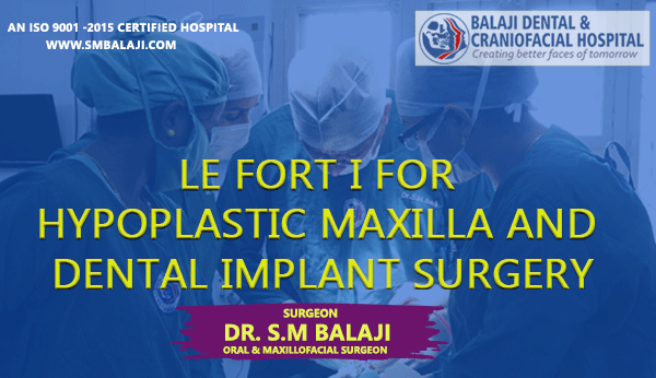 Le Fort I for Hypoplastic Maxilla and Dental Implant Surgery