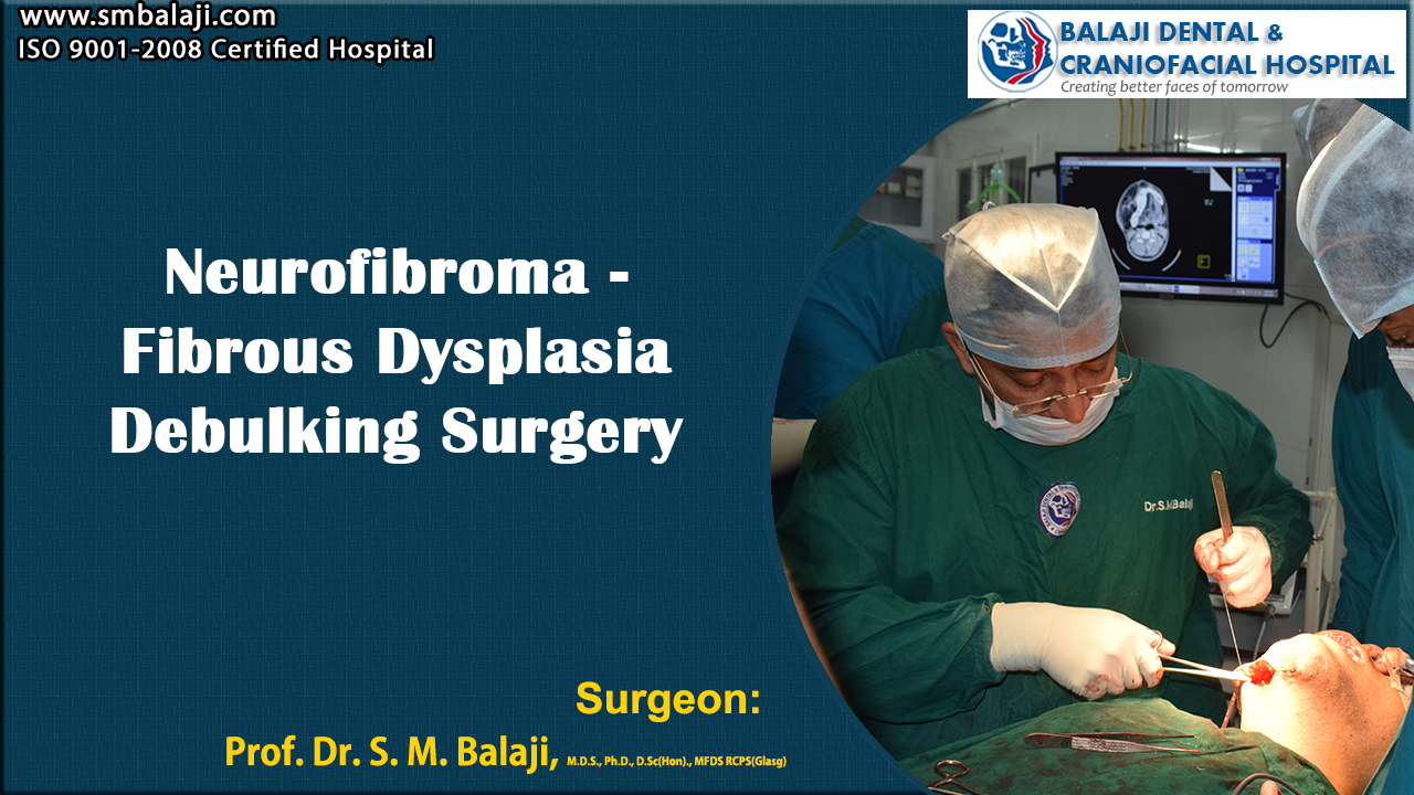 Neurofibroma – Fibrous Dysplasia Debulking Surgery