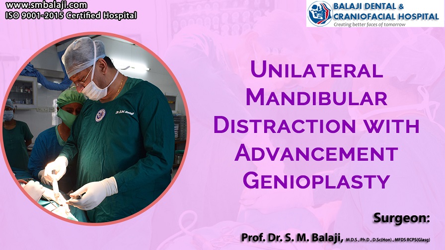 Unilateral Mandibular Distraction with Advancement Genioplasty