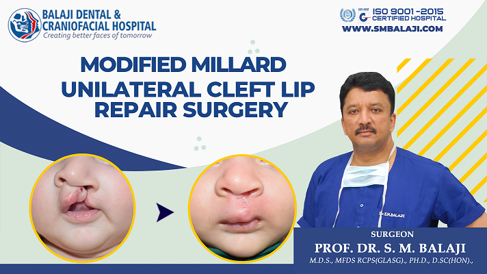 Modified Millard Unilateral Cleft Lip Repair Surgery