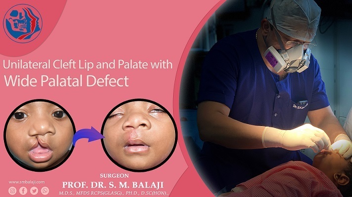 Unilateral Cleft Lip and Palate Deformity