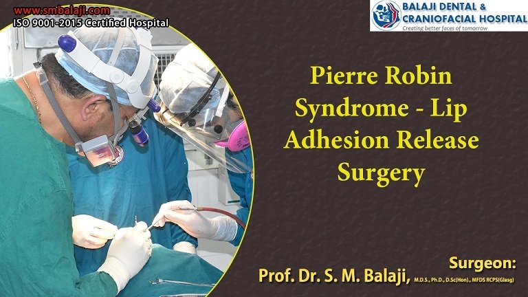 Pierre Robin Syndrome – Lip Adhesion Release Surgery