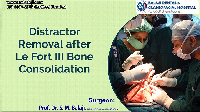 Distractor Removal after Le Fort III Bone Consolidation