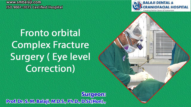 Fronto orbital Complex Fracture Surgery (Eye level Correction)