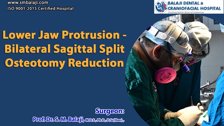 Lower Jaw Protrusion – Bilateral Sagittal Split Osteotomy Reduction