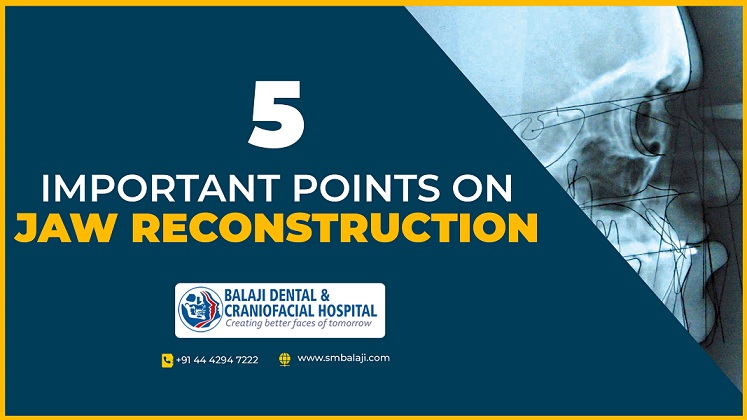 5 Important Points you should know about Jaw Reconstruction Surgery