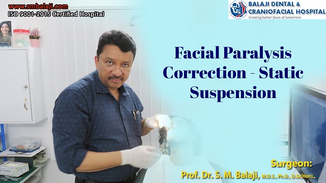 Facial Paralysis Surgery – Static Suspension