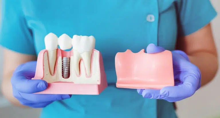 The Process Of Making Dental Crowns