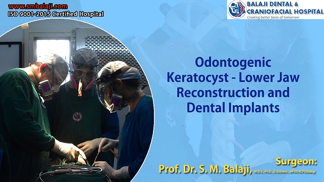 Odontogenic Keratocyst – Jaw Reconstruction and Dental Implants