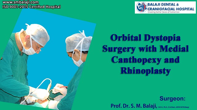 Orbital Dystopia Surgery with Medial Canthopexy and Rhinoplasty