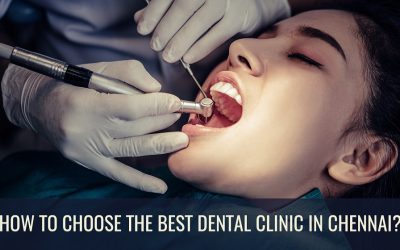 How To Choose The Best Dental Clinic In Chennai?